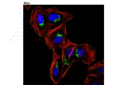Immunofluorescence Image 1: Rab6 (D37C7) Rabbit Monoclonal Antibody