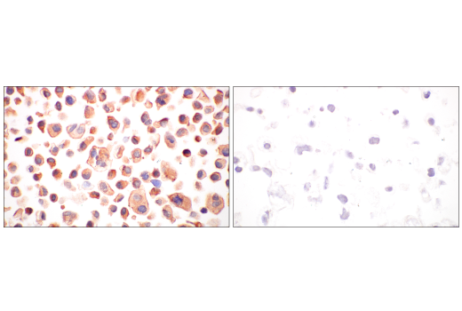 Immunohistochemistry Image 4: B-Raf (V600E Mutant) (IHC600) Mouse Monoclonal Antibody