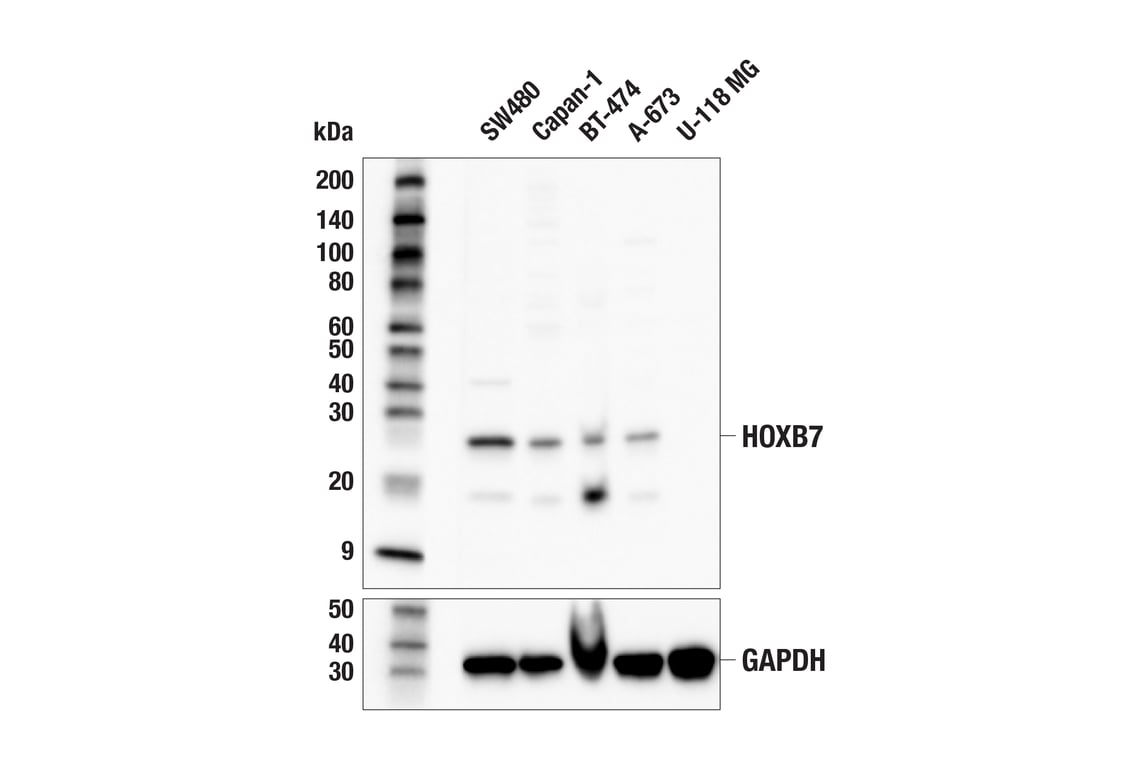 Western Blotting Image 1: HOXB7 (E3H4S) Rabbit mAb