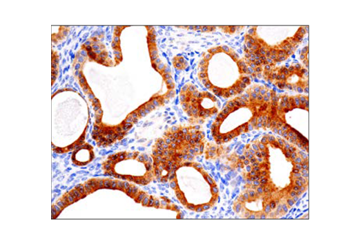 Immunohistochemistry Image 1: Bcl-2 (124) Mouse Monoclonal Antibody