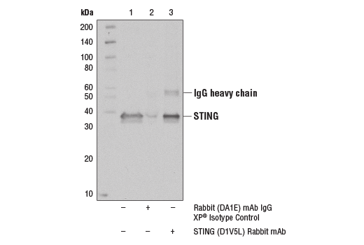 Immunoprecipitation Image 1: STING (D1V5L) Rabbit Monoclonal Antibody
