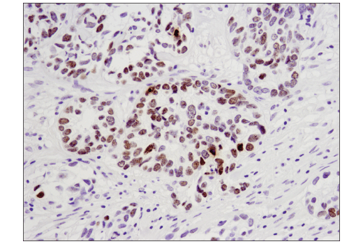 Immunohistochemistry Image 3: Phospho-Histone H2A.X (Ser139) (D7T2V) Mouse Monoclonal Antibody