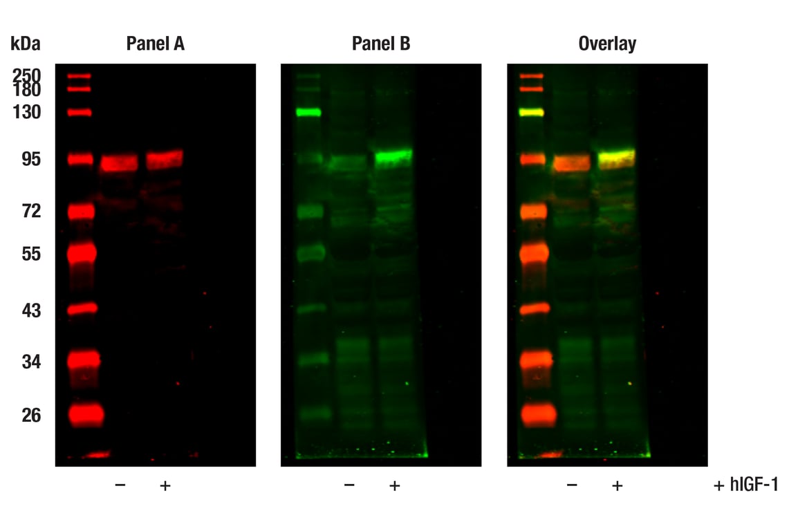 Phospho-FoxO3a (Ser253) (D18H8) Rabbit Monoclonal Antibody | Cell