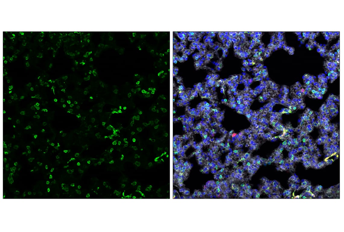 Immunofluorescence Image 2: MHC Class II (I-A/I-E) (M5/114.15.2) Rat Monoclonal Antibody