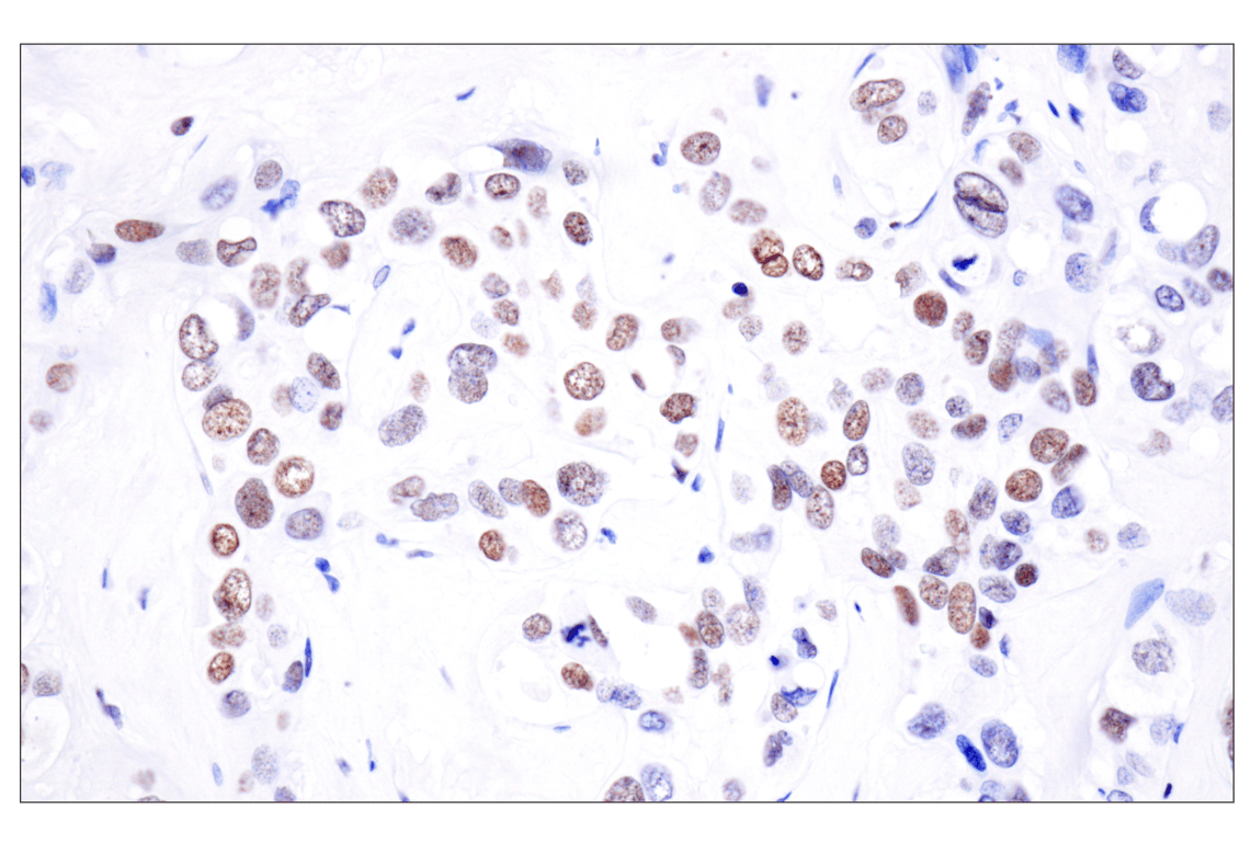 Immunohistochemistry Image 3: Acetyl-Histone H4 (Lys16) (E2B8W) Rabbit Monoclonal Antibody