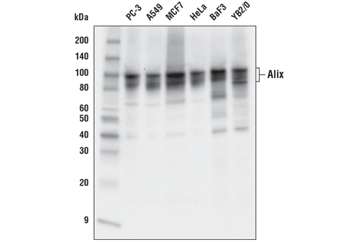 Western Blotting Image 2: Alix (E6P9B) Rabbit Monoclonal Antibody