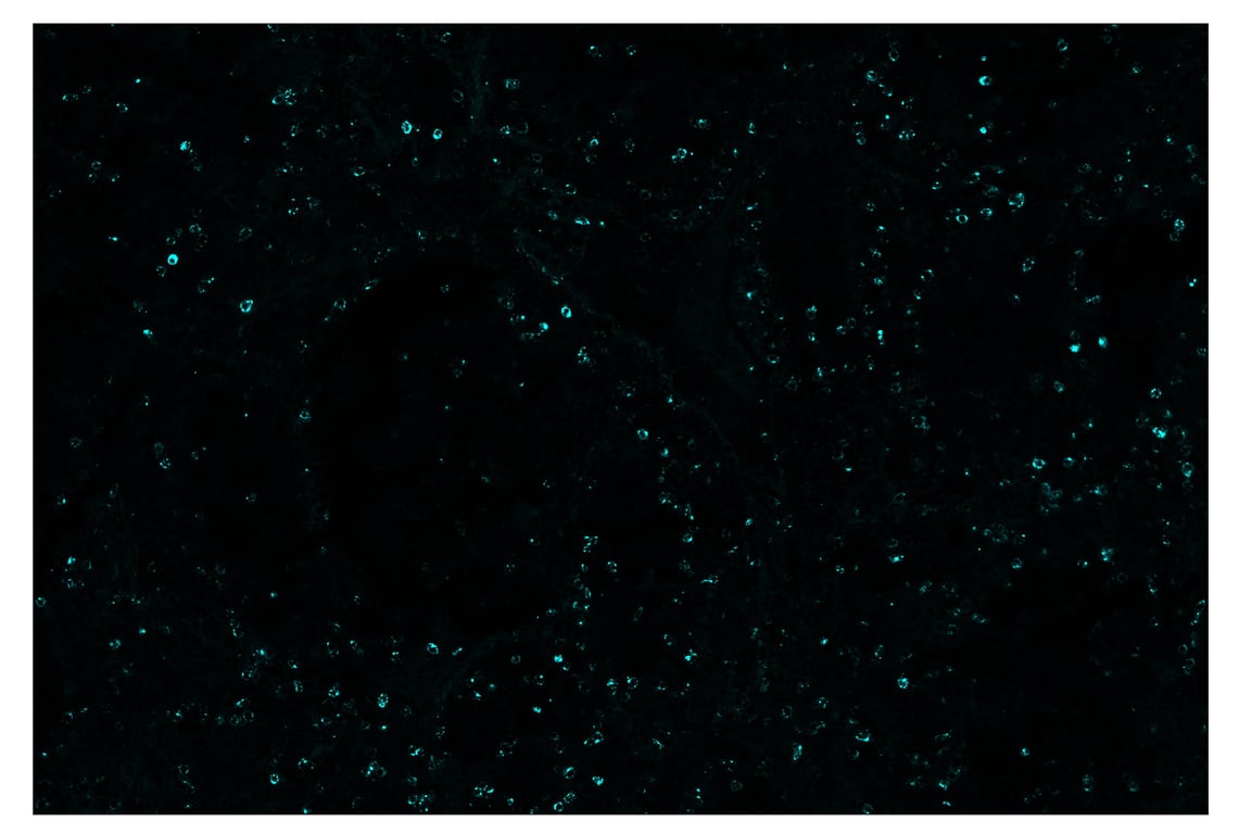 Immunohistochemistry Image 5: LAG3 (D2G4O) & CO-0026-647 SignalStar<sup>®</sup> Oligo-Antibody Pair