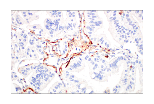 Immunohistochemistry Image 6: ApoE4 (E5M4L) Rabbit Monoclonal Antibody