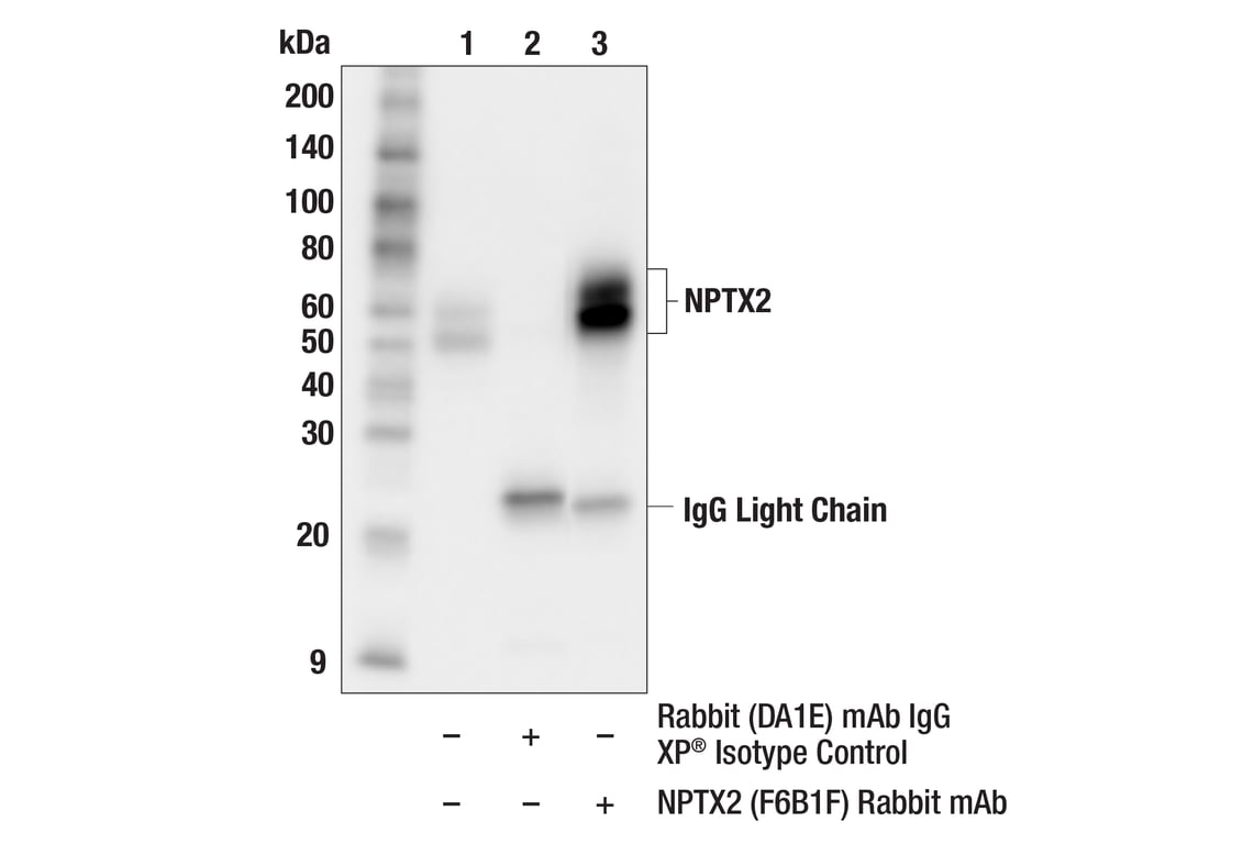 Immunoprecipitation Image 1: NPTX2 (F6B1F) Rabbit Monoclonal Antibody