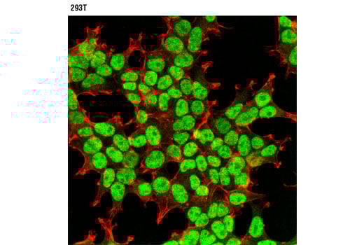 undefined Image 26: Huntingtin Interaction Antibody Sampler Kit
