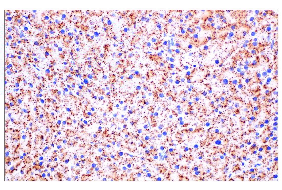 undefined Image 38: Genetics of Parkinson's Disease: Lysosomal Dysfunction Antibody Sampler Kit