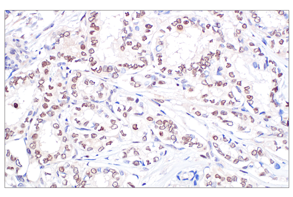 Immunohistochemistry Image 5: TFE3 (F3Z2Q) Rabbit Monoclonal Antibody