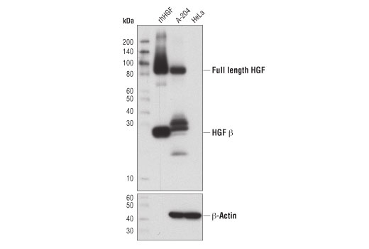 undefined Image 6: Cancer-associated Growth Factor Antibody Sampler Kit