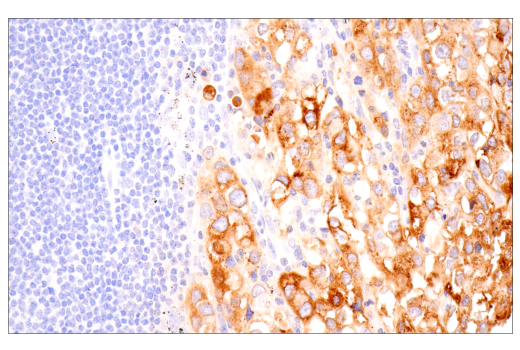 Immunohistochemistry Image 4: Furin (E2Y2F) Rabbit Monoclonal Antibody
