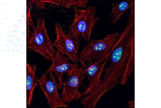 Immunofluorescence Image 1: SENP3 (D20A10) Rabbit Monoclonal Antibody
