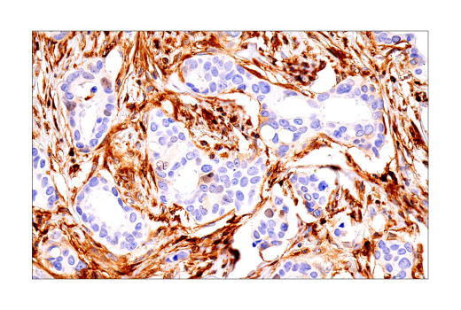 undefined Image 14: Ferroptosis Antibody Sampler Kit
