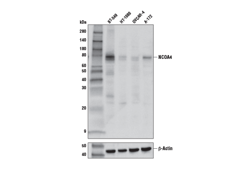 Western Blotting Image 1: NCOA4 (E8H8Z) Rabbit mAb