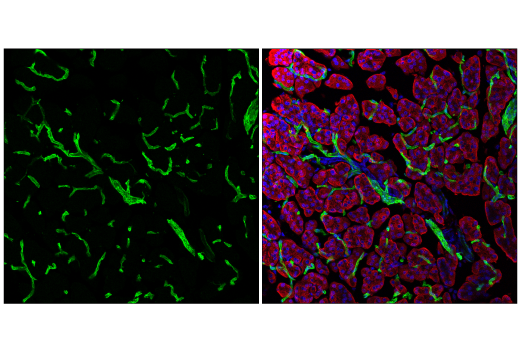 Immunofluorescence Image 2: PLVAP (E9W8D) Rabbit Monoclonal Antibody