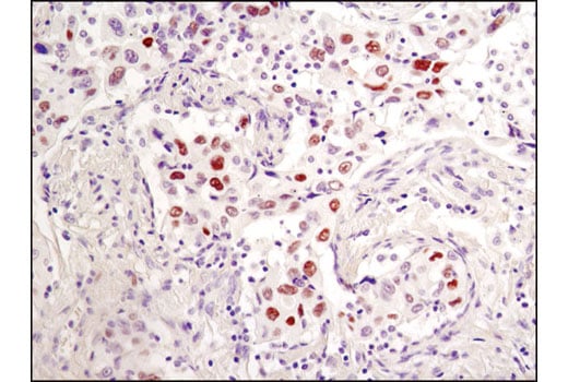Immunohistochemistry Image 3: Phospho-c-Jun (Ser73) (D47G9) Rabbit Monoclonal Antibody