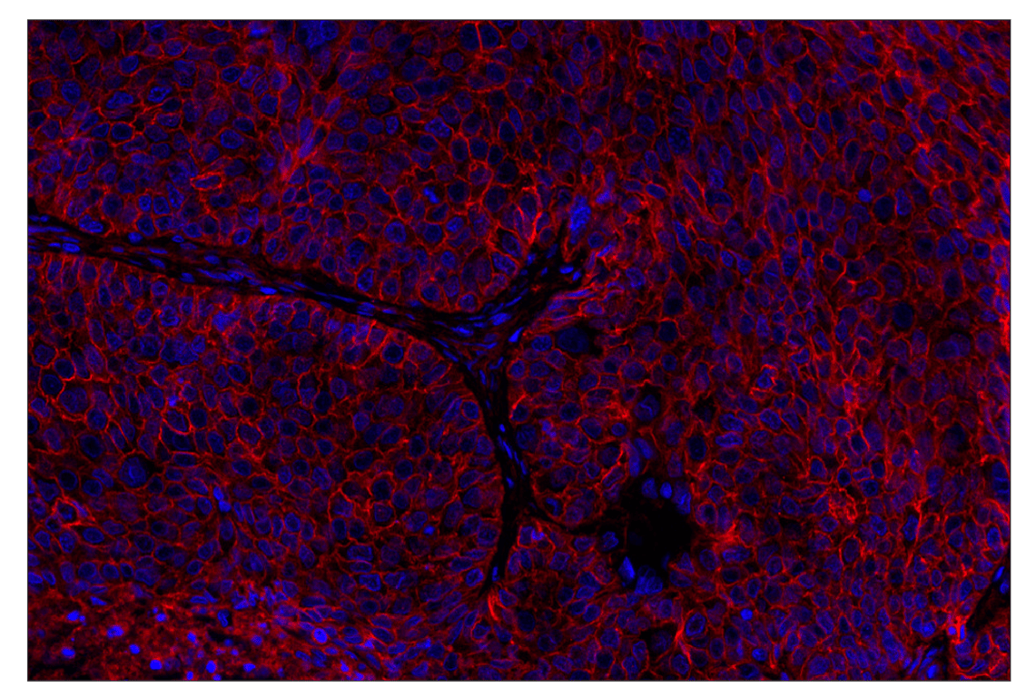 Immunohistochemistry Image 1: B7-H3 (D9M2L) XP<sup>®</sup> Rabbit mAb (Alexa Fluor<sup>®</sup> 555 Conjugate)