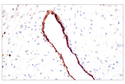 Immunohistochemistry Image 4: Nestin (E4O9E) XP<sup>®</sup> Rabbit mAb