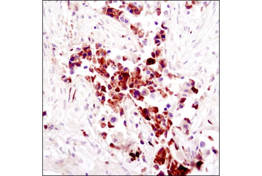 Immunohistochemistry Image 1: FGF Receptor 1 (D8E4) Rabbit Monoclonal Antibody