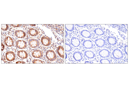 Immunohistochemistry Image 9: UBAP2L (E5X4E) Rabbit Monoclonal Antibody