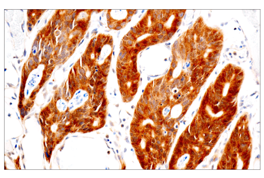 Immunohistochemistry Image 1: VHL (E3X9K) Rabbit Monoclonal Antibody