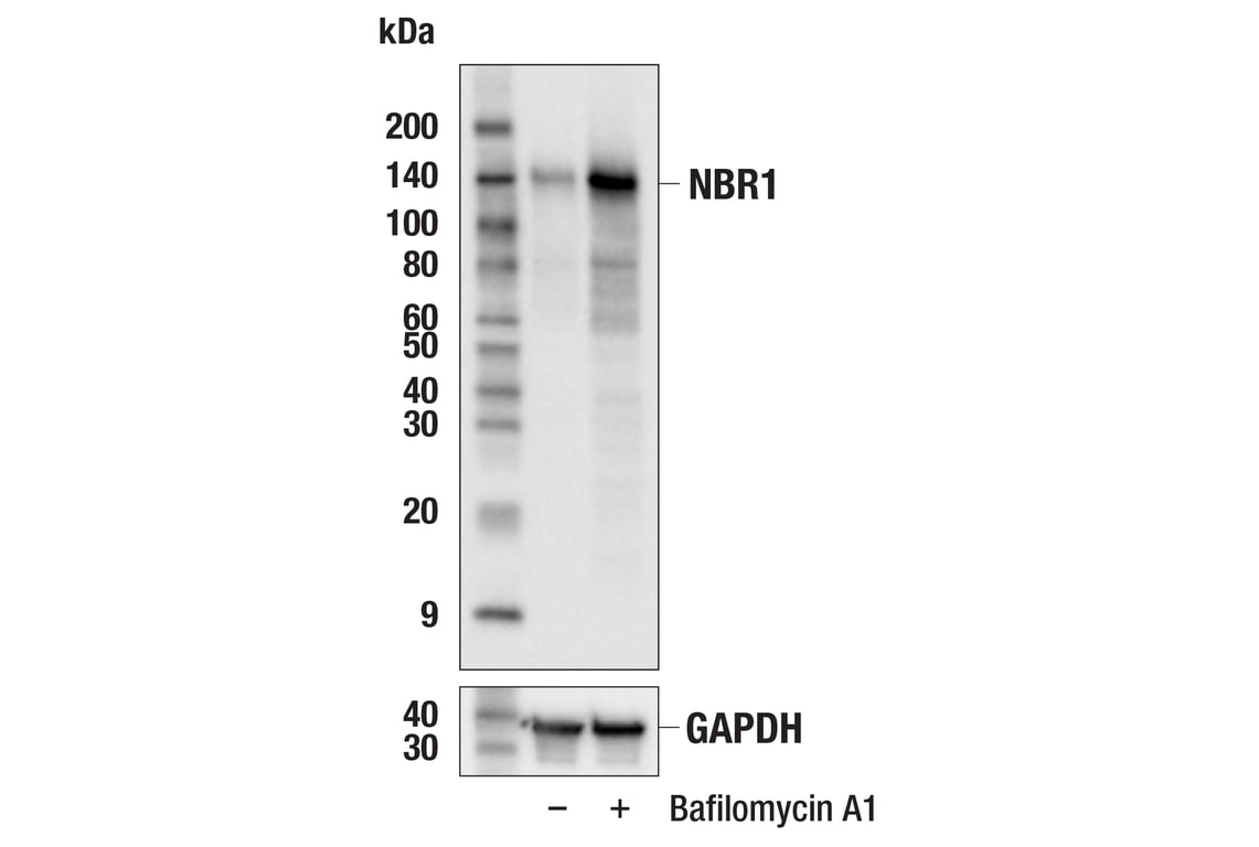 Western Blotting Image 4: NBR1 (E6Q3F) Rabbit Monoclonal Antibody
