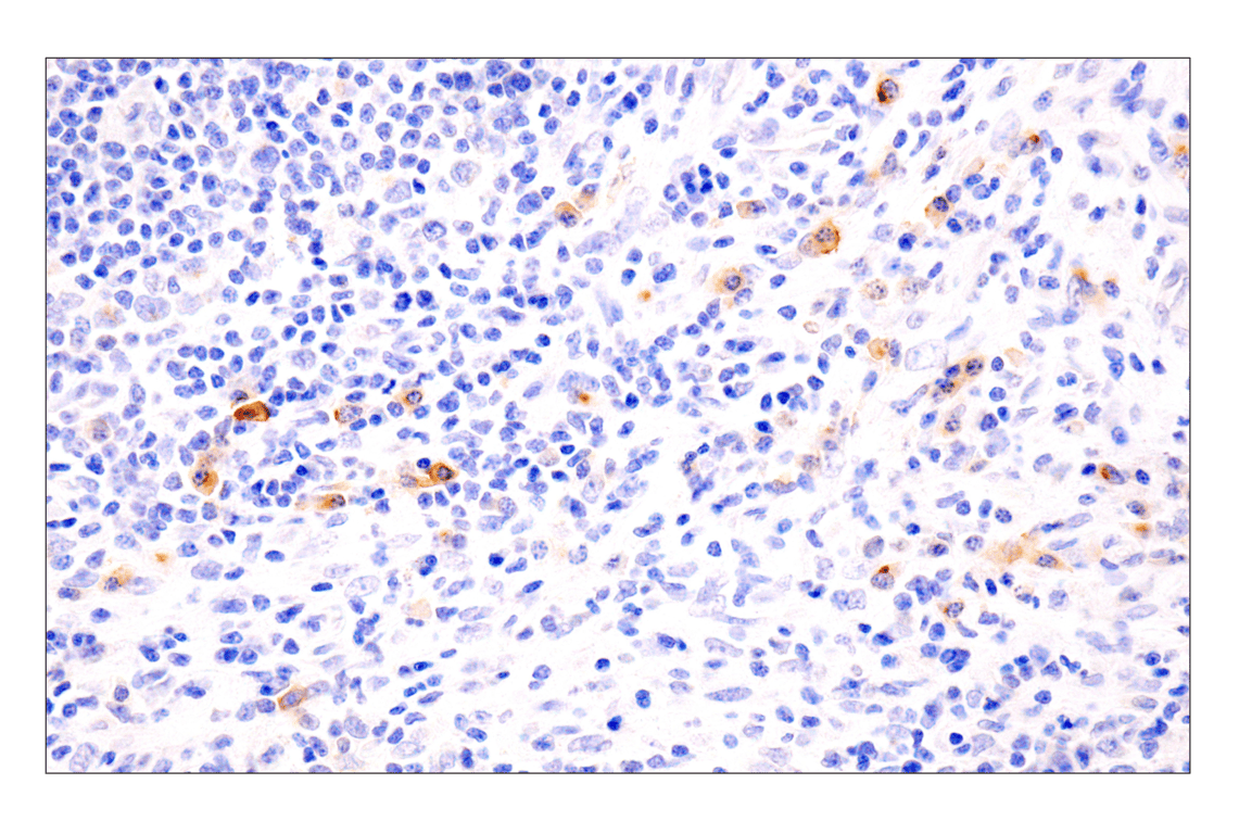 Immunohistochemistry Image 2: TNFRSF17/BCMA (E6D7B) Rabbit Monoclonal Antibody