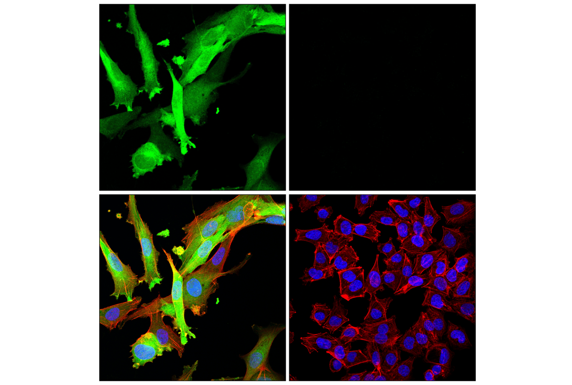 Immunofluorescence Image 1: HSP20 (E9Z1O) Rabbit Monoclonal Antibody