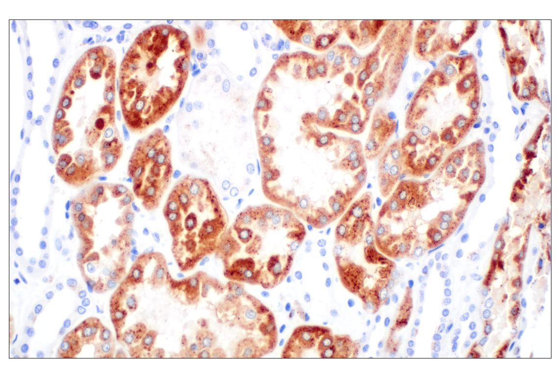 Cathepsin Z (F4M4S) Rabbit Monoclonal Antibody | Cell Signaling