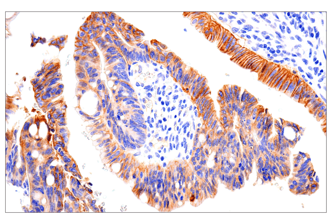 Immunohistochemistry Image 3: EphA2 (D4A2) Rabbit Monoclonal Antibody
