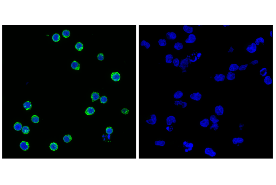 Immunofluorescence Image 1: Lck (D88) Rabbit Monoclonal Antibody
