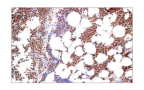 Immunohistochemistry Image 2: Helios (E4L5U) Rabbit Monoclonal Antibody