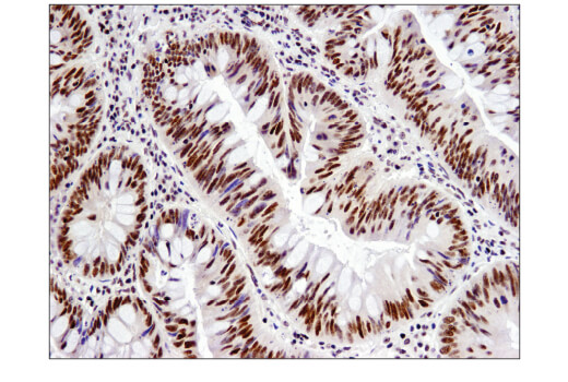 Immunohistochemistry Image 3: NCoR1 (E4S4N) Rabbit Monoclonal Antibody