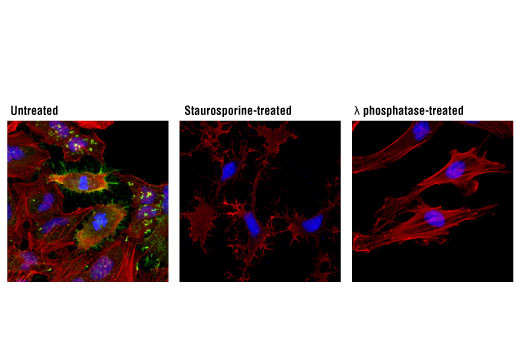 Immunofluorescence Image 1: Phospho-Ezrin (Thr567)/Radixin (Thr564)/Moesin (Thr558) (48G2) Rabbit Monoclonal Antibody (BSA and Azide Free)