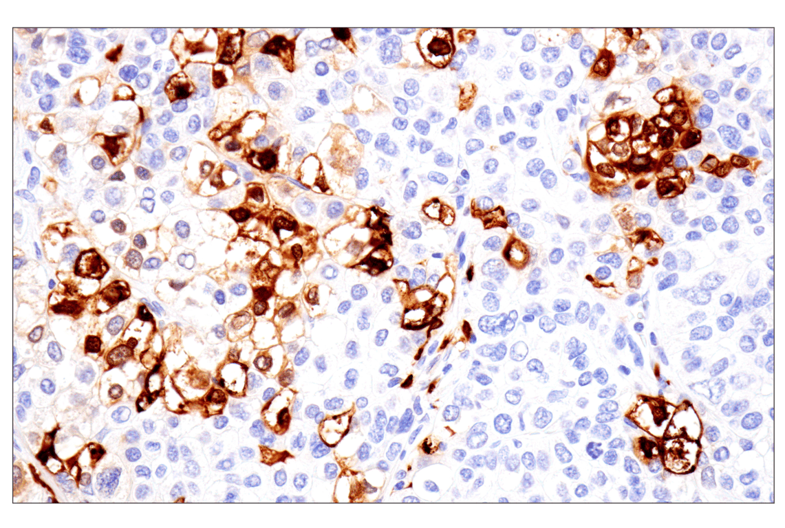 Immunohistochemistry Image 3: S100A8 (F4R2W) Rabbit Monoclonal Antibody