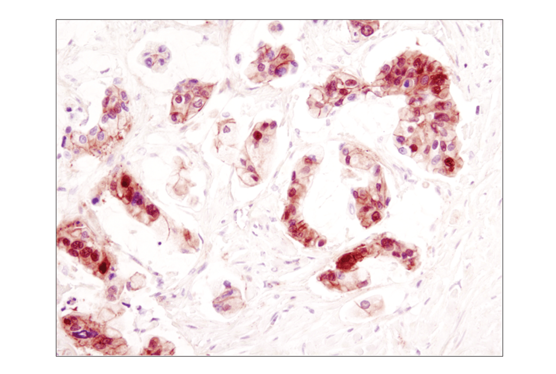 Immunohistochemistry Image 4: beta-Catenin (D10A8) Rabbit Monoclonal Antibody