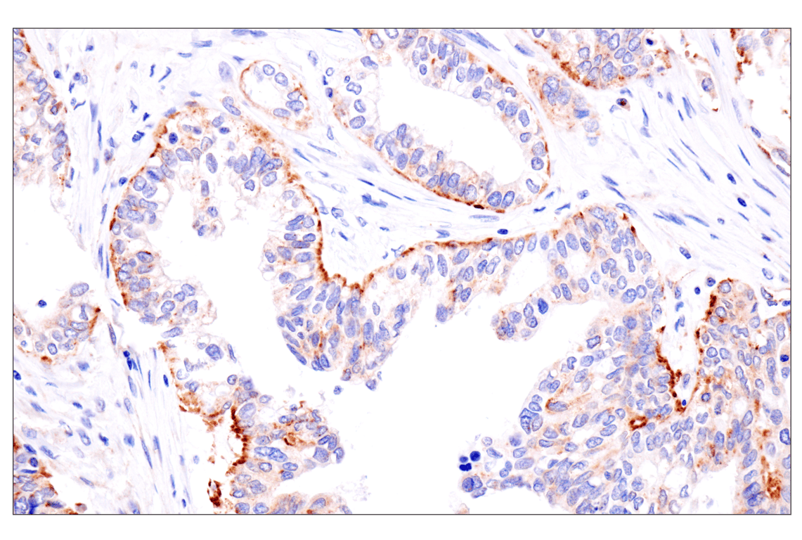 Immunohistochemistry Image 2: Presenilin 2 (F7E5Q) Rabbit Monoclonal Antibody