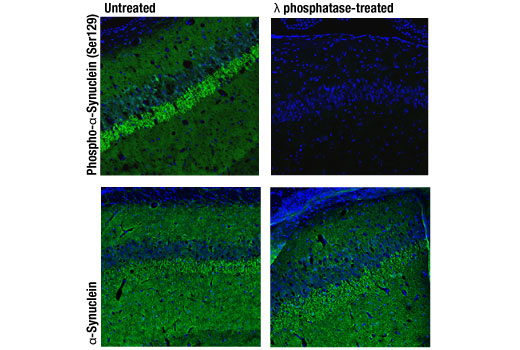 Immunofluorescence Image 3: Phospho-alpha-Synuclein (Ser129) (D1R1R) Rabbit Monoclonal Antibody (BSA and Azide Free)