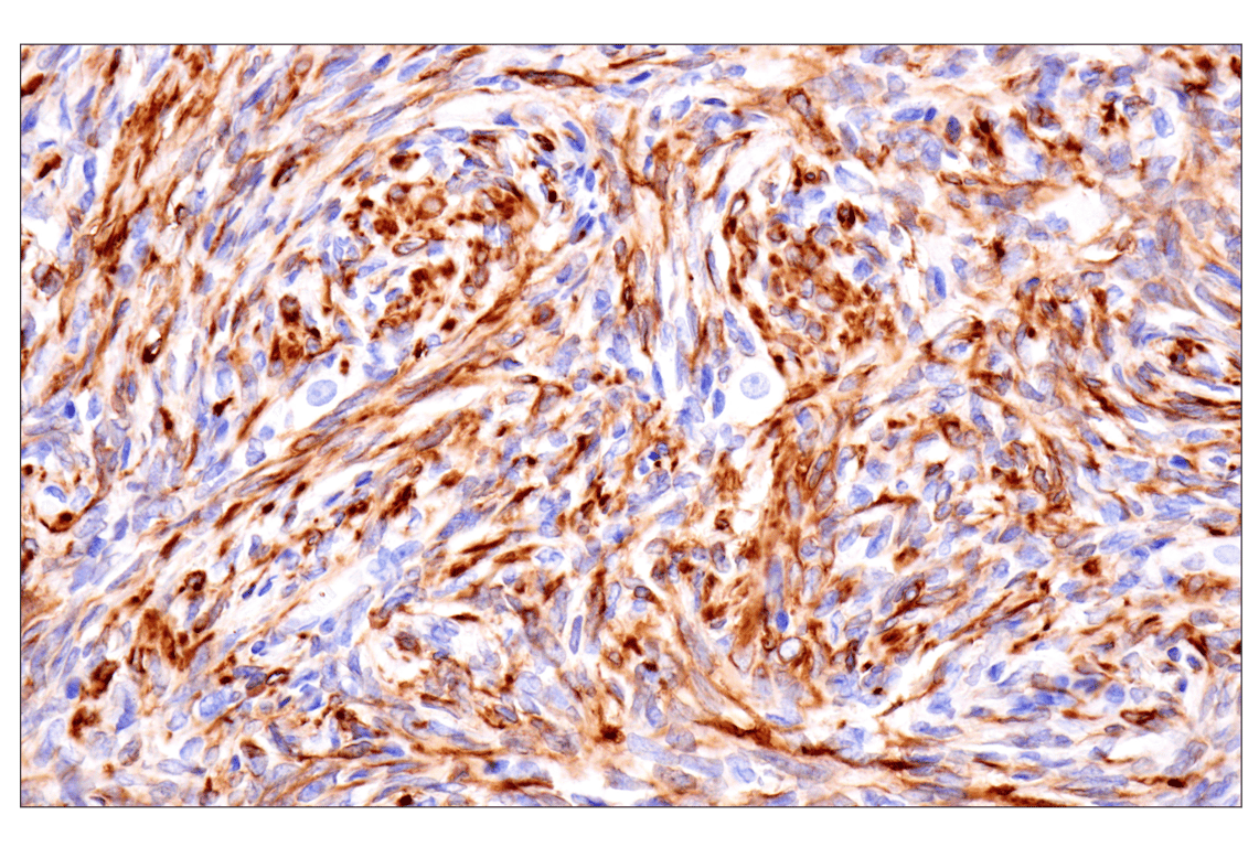 Immunohistochemistry Image 9: Desmin (F5V4I) Rabbit Monoclonal Antibody
