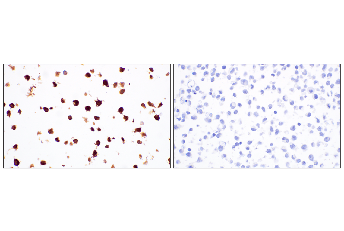 Immunohistochemistry Image 10: Catalase (D4P7B) Rabbit Monoclonal Antibody