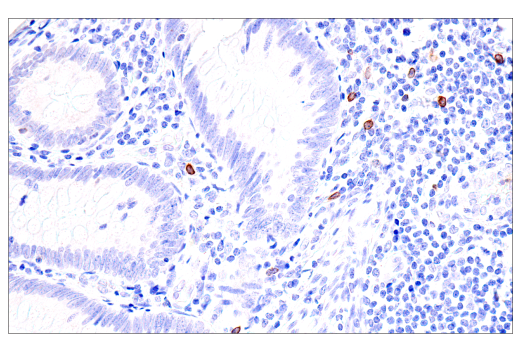 Immunohistochemistry Image 7: GNLY (E2T3D) Rabbit Monoclonal Antibody