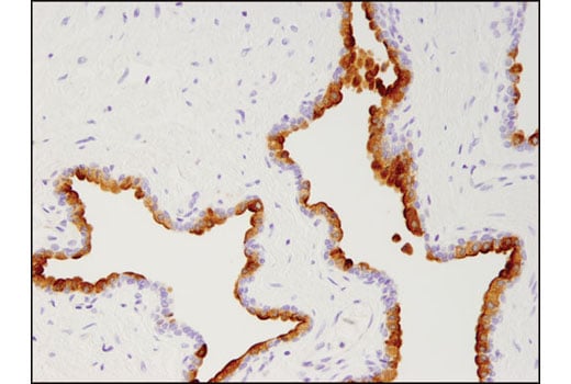 Immunohistochemistry Image 1: Prostate Specific Membrane Antigen (D7I8E) Rabbit Monoclonal Antibody (BSA and Azide Free)