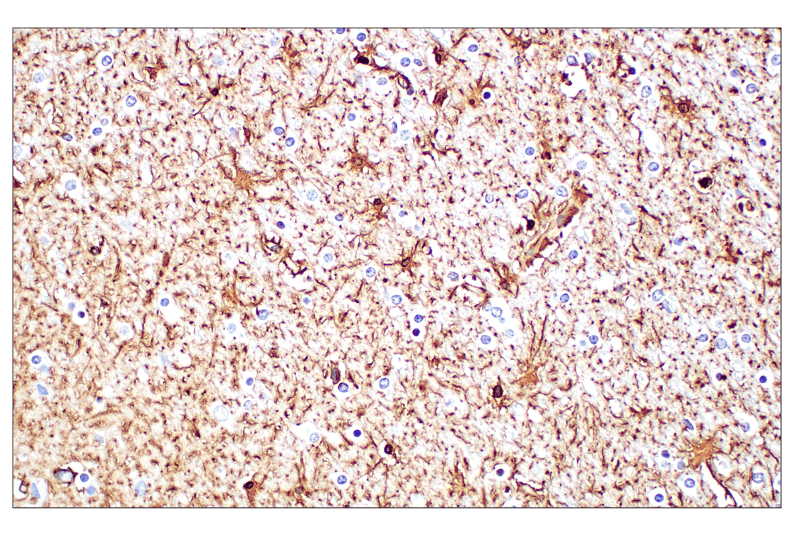 Immunohistochemistry Image 7: GFAP (E4L7M) XP<sup>®</sup> Rabbit mAb (BSA and Azide Free)