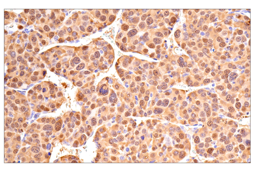Immunohistochemistry Image 12: Galectin-3/LGALS3 (E7B6R) Rabbit Monoclonal Antibody (BSA and Azide Free)