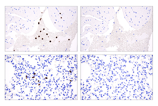 Immunohistochemistry Image 4: S100A8 (E4F8V) Rabbit Monoclonal Antibody