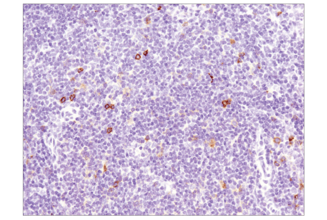 Immunohistochemistry Image 6: OX40 (E9U7O) Rabbit Monoclonal Antibody (BSA and Azide Free)