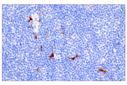 Immunohistochemistry Image 2: Factor XIIIA (E980.1) Mouse Monoclonal Antibody